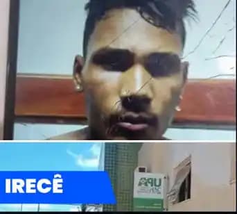 Irecê - Disfarce na UPA: Homem é preso em flagrante após fingir ferimento para furtar motocicleta