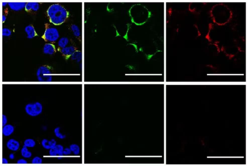 Pesquisadores da USP descobrem técnica de ultrassom para destruir vírus da Covid-19 e Gripe